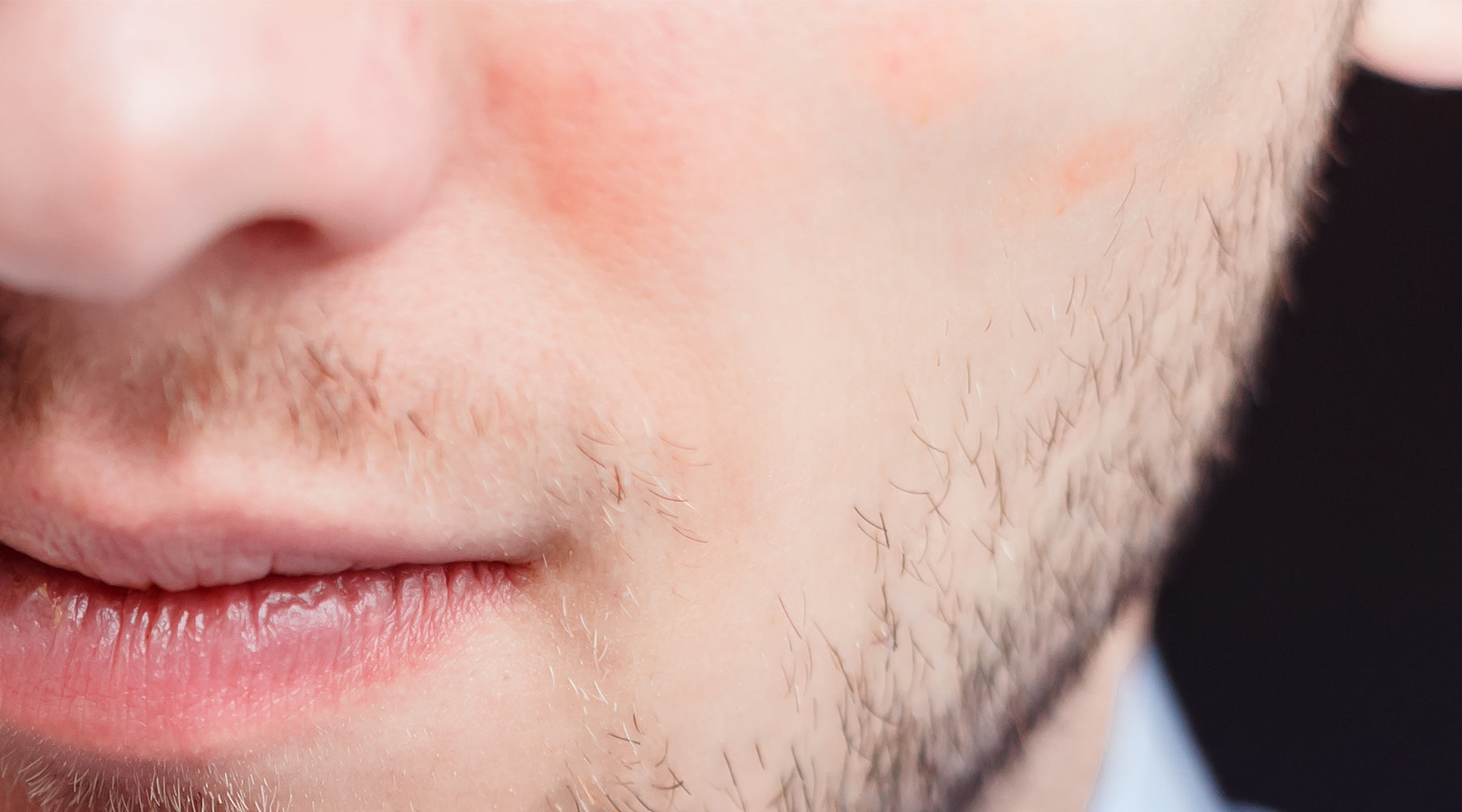 Retinol Cream Side Effects