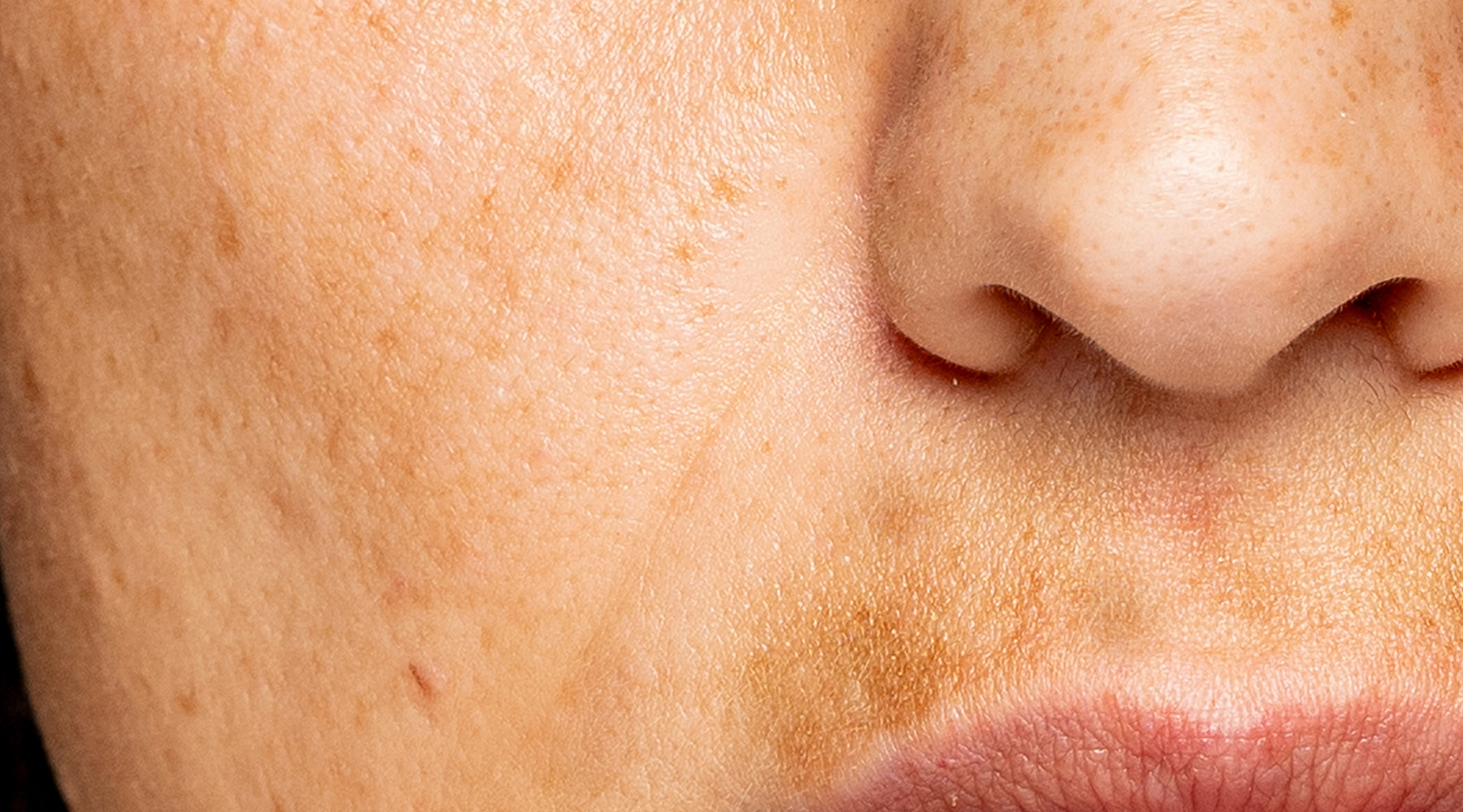 Retinol Cream for Dark Spots