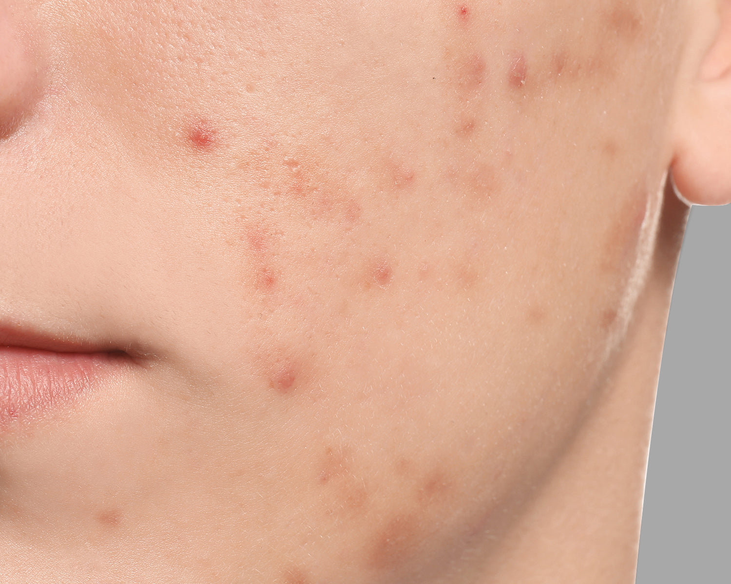 remove the look of dark spots and hyperpigmentation