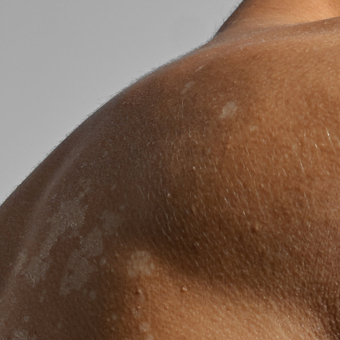 tamanu promotes wound healing