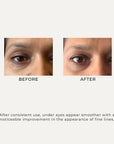 Multi Peptide Hydro Eye Gel