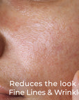 Reduce the look of fine lines and wrinkles